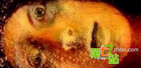 19岁女子全身被冻僵像冷冻肉 谁知竟奇迹复活