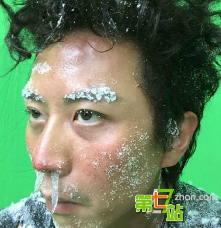 19岁女子全身被冻僵像冷冻肉 谁知竟奇迹复活