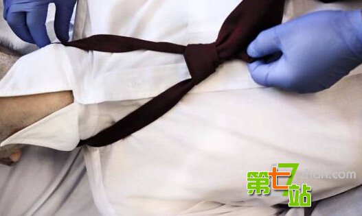 摘除大部分内脏也能活？人体十大惊人事实