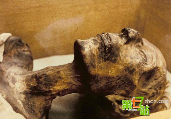组图：揭秘那些死因“神秘”的木乃伊
