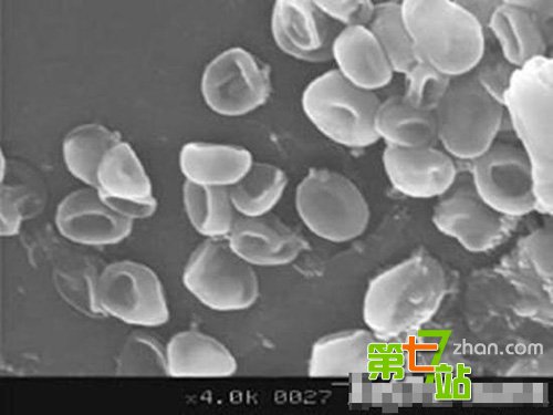 印度天降红雨 疯传的“外星生物说”成焦点