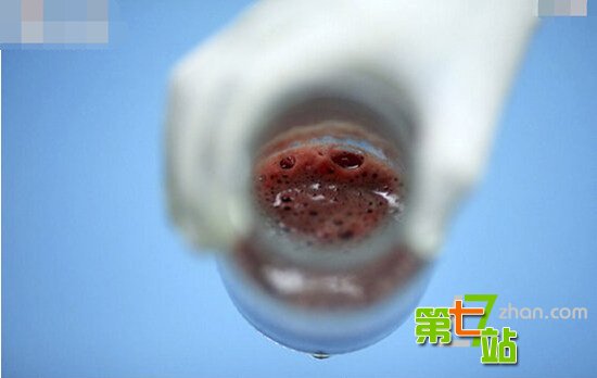 少女人流术全过程曝光男人傻眼