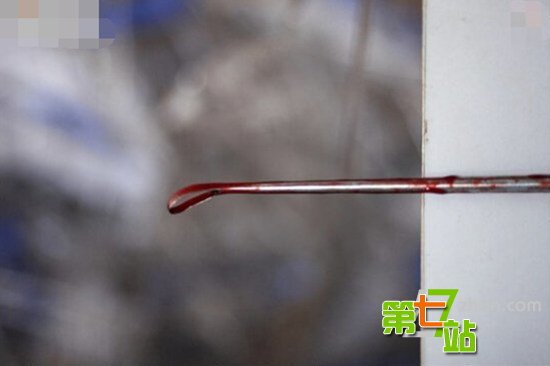 少女人流术全过程曝光男人傻眼