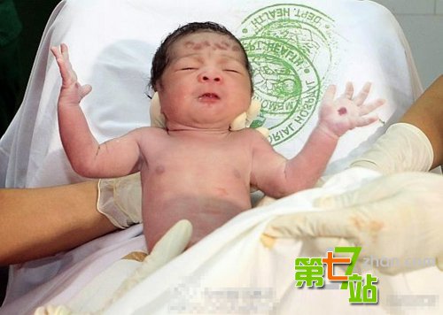 人体“圣痕”之谜：诡异的人体超自然现象